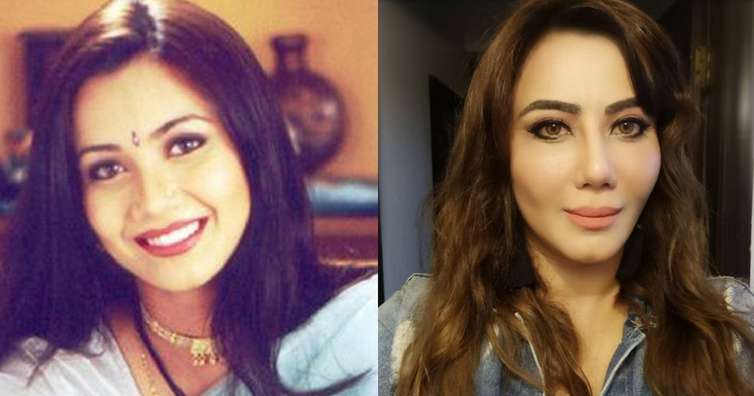 Photo of छोटे पर्दे की वो सेलिब्रिटी जिन्होंने सुंदर दिखने के लिए गंवा दी अपनी खूबसूरती