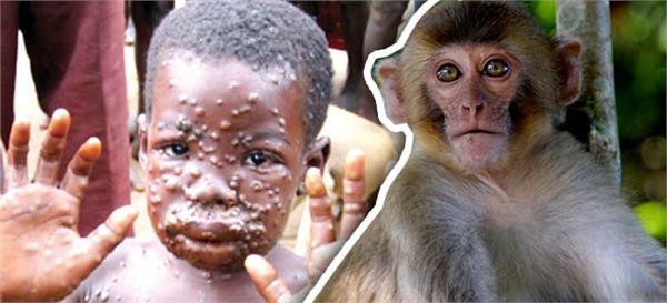 monkeypox