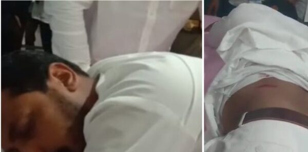 Photo of UP के देवबंद में भीम आर्मी चीफ चंद्रशेखर आज़ाद को बदमाशों ने मारी गोली