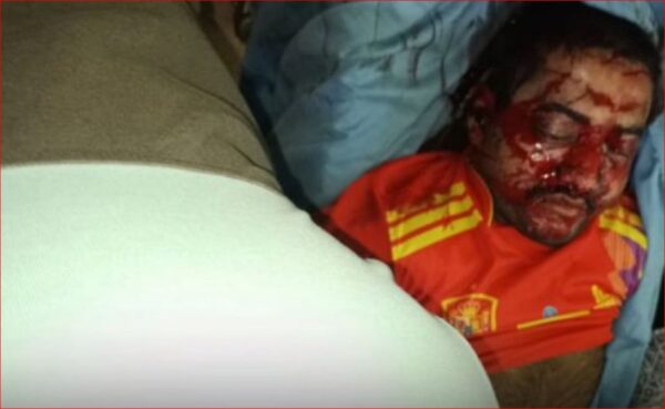 Photo of बदलापुर कांड के आरोपी अक्षय शिंदे एनकाउंटर में ढेर