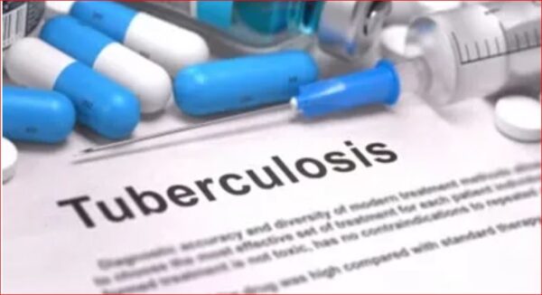 Photo of UP में टीबी अभियान के 69 दिन में 89,967 टीबी मरीज चिन्हित