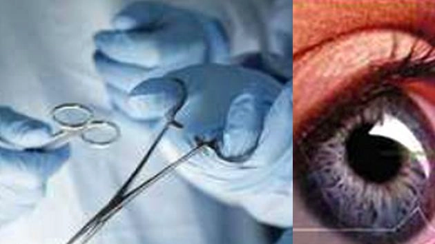 Photo of 30 मरीजों के मोतियाबिंद ऑपरेशन के बाद फैला संक्रमण, 10 की गई रोशनी